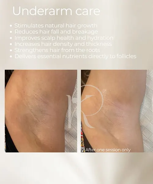 Derma-2